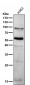 Anti-PPAR gamma Rabbit Monoclonal Antibody